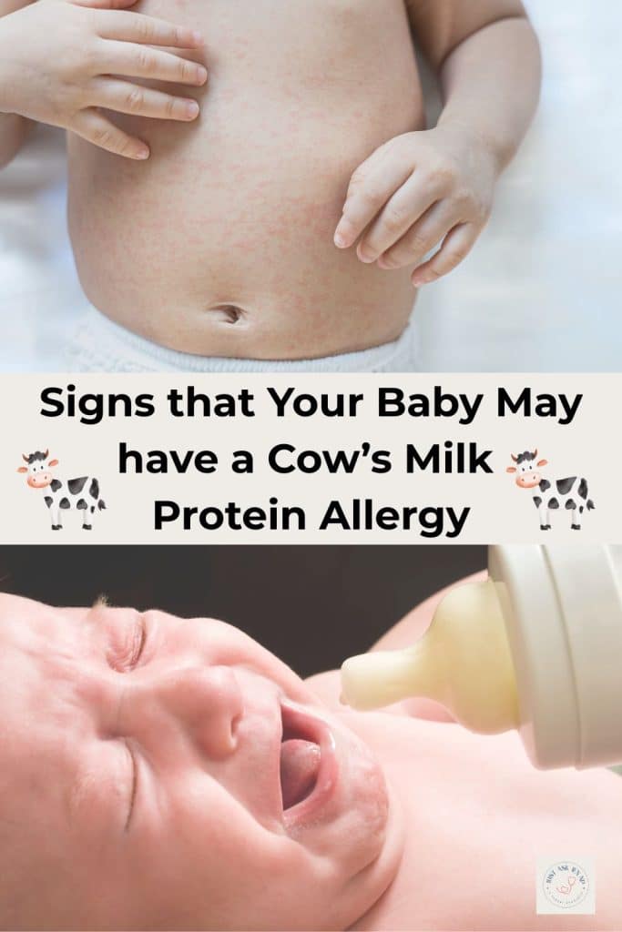 cows milk allergy