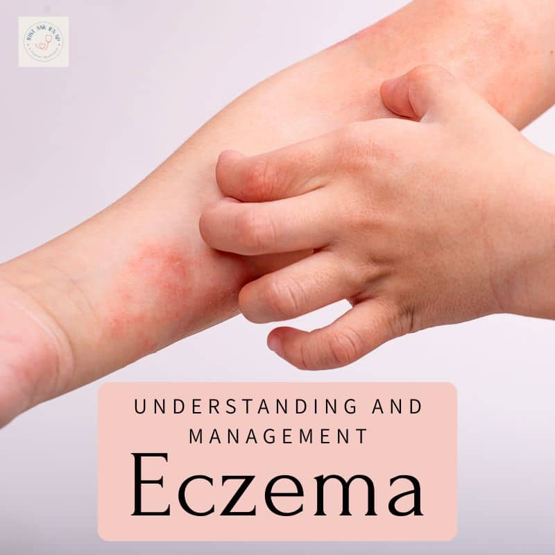 eczema